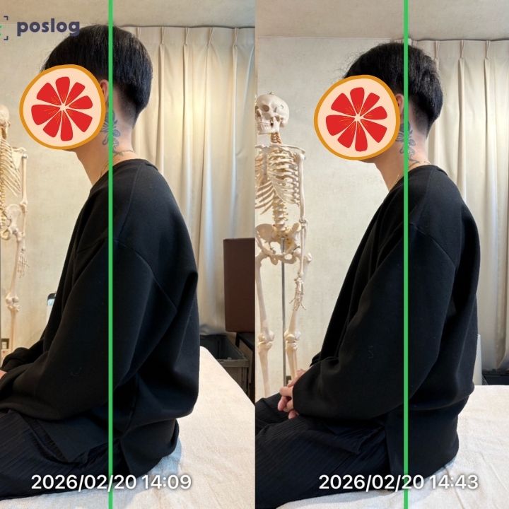 右肩の引っかかり感とクリック音の改善事例
