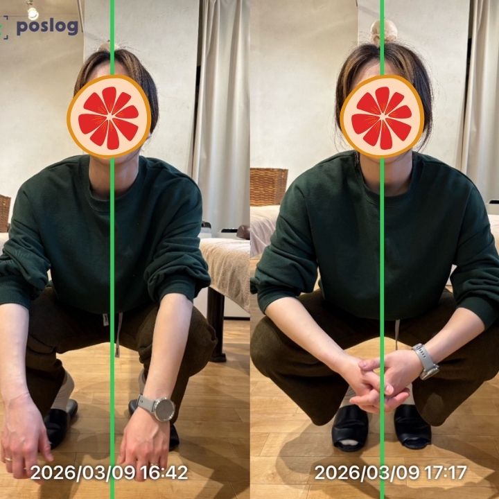 左股関節と左膝の痛みの改善事例