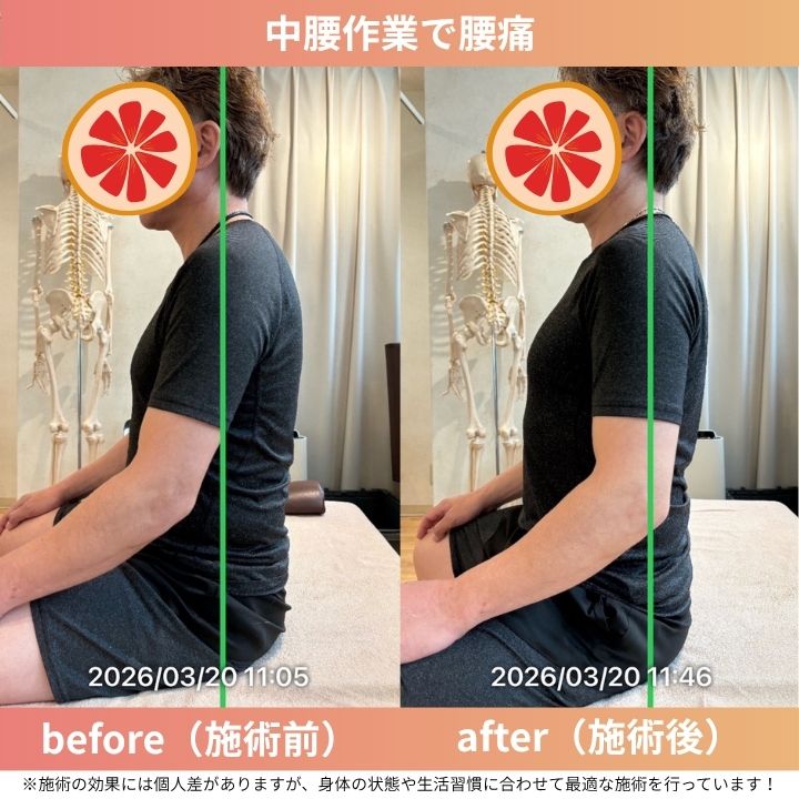 前かがみ作業で腰痛が出た40代男性の事例