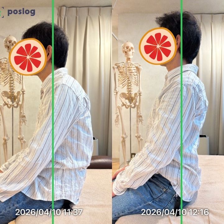 毎日ストレッチしても悪化した40代男性の事例