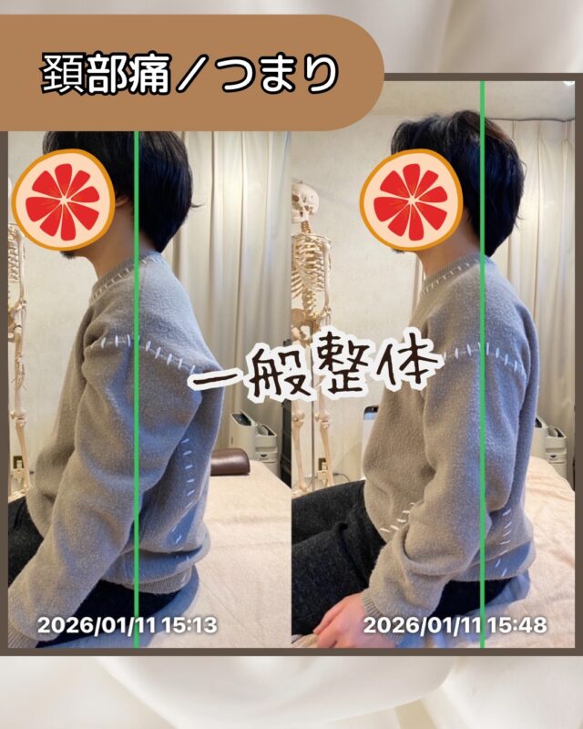 心斎橋】骨盤矯正「全身バランスに特化した独自矯正法」で人気の接骨院